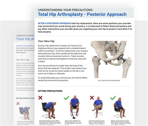 posterior hip precautions handout